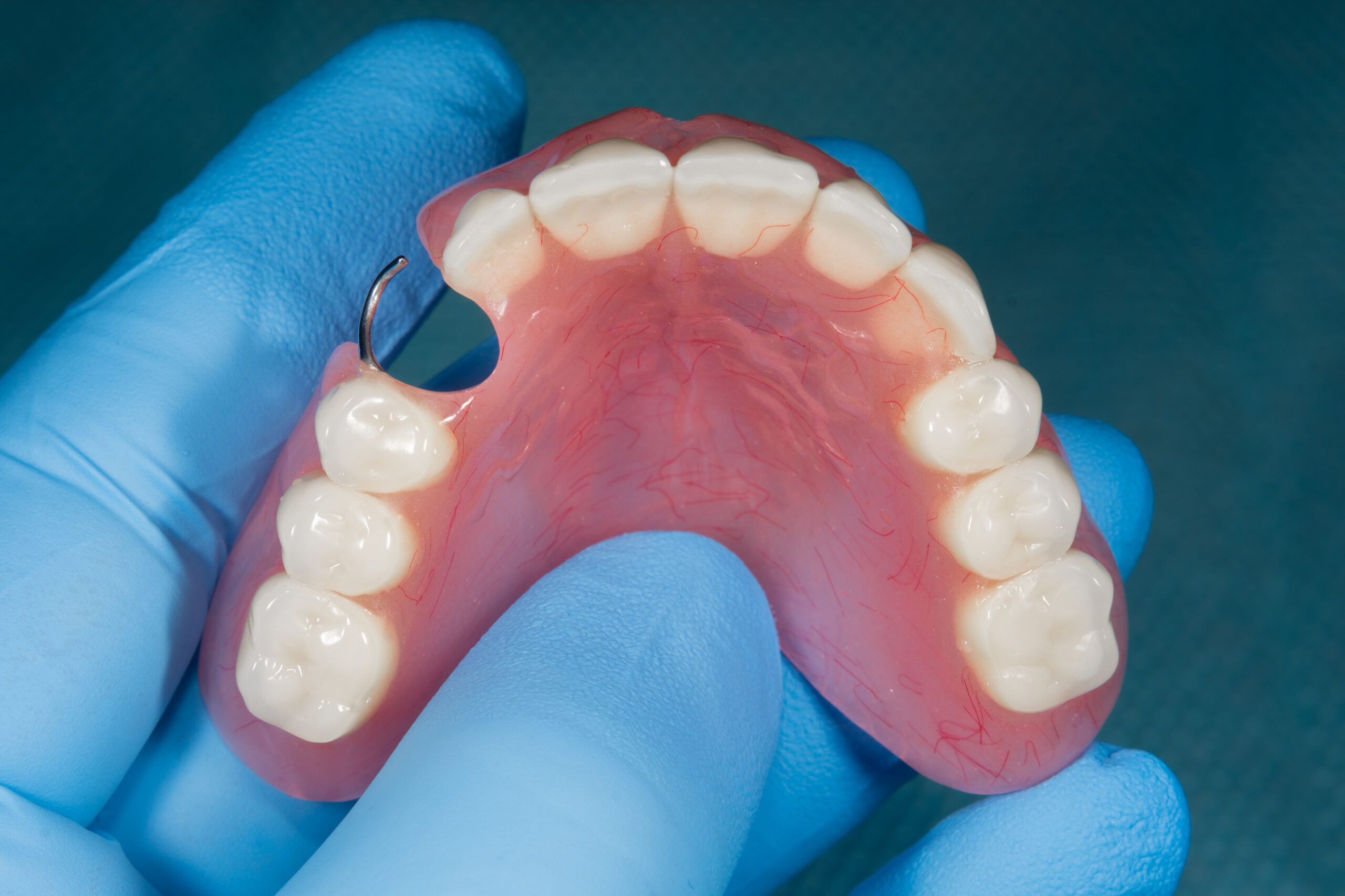 Close-up human partial denture of the upper jaw on a blue background in the hand of a dentist wearing a medical glove