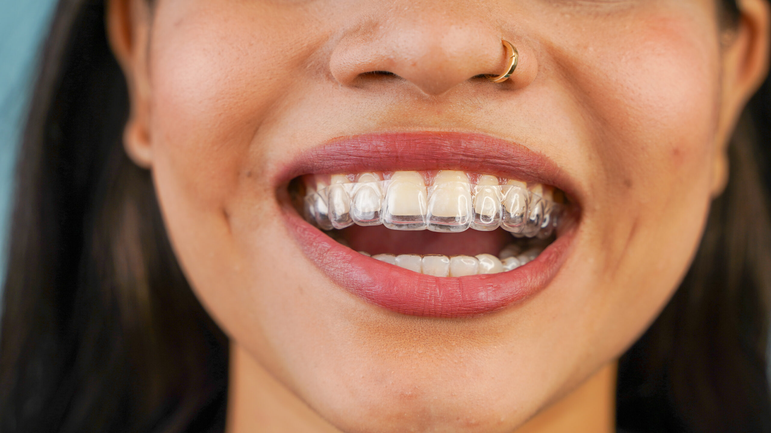 woman with teeth aligners